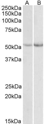 IHC-plus™ PH / PAH Antibody (aa66-76)