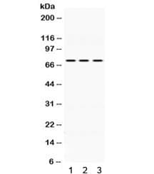 IL2RB / CD122 Antibody