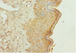 Polyclonal Rabbit anti-Human GALNT3 Antibody (IHC)
