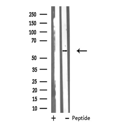 CYP51A1 / CYP51 Antibody