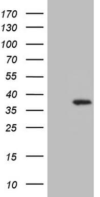 Monoclonal Mouse anti-Human UTP11L Antibody (clone OTI5F3, IHC, WB)