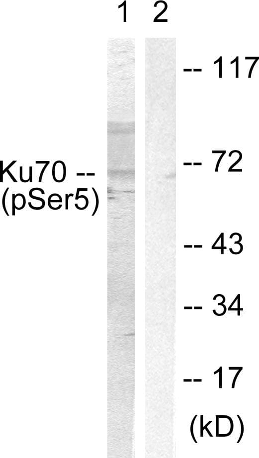 XRCC6 / Ku70 Antibody (phospho-Ser5)