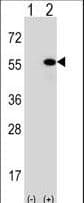 Polyclonal Rabbit anti-Human DNAJA1 / HDJ2 Antibody (aa294-323, IHC, WB)