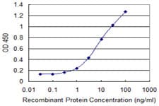 IHC-plus™ SMO / Smoothened Antibody (clone 3D10)