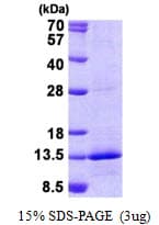 Human NDUFB4 / B15 Protein (Recombinant His)