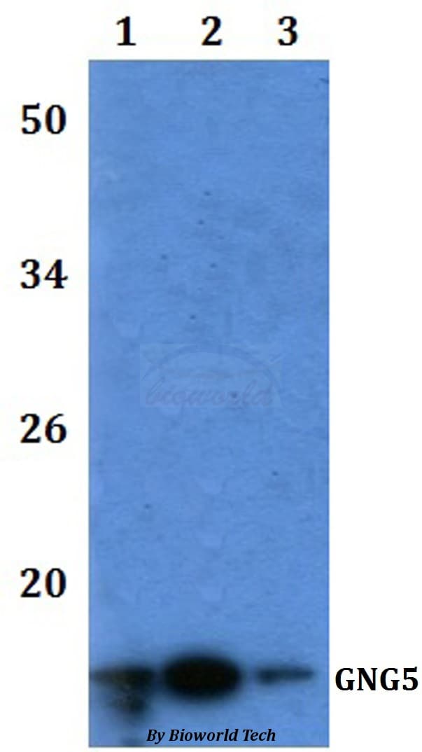 Polyclonal Rabbit anti-Human GNG5 Antibody (WB)