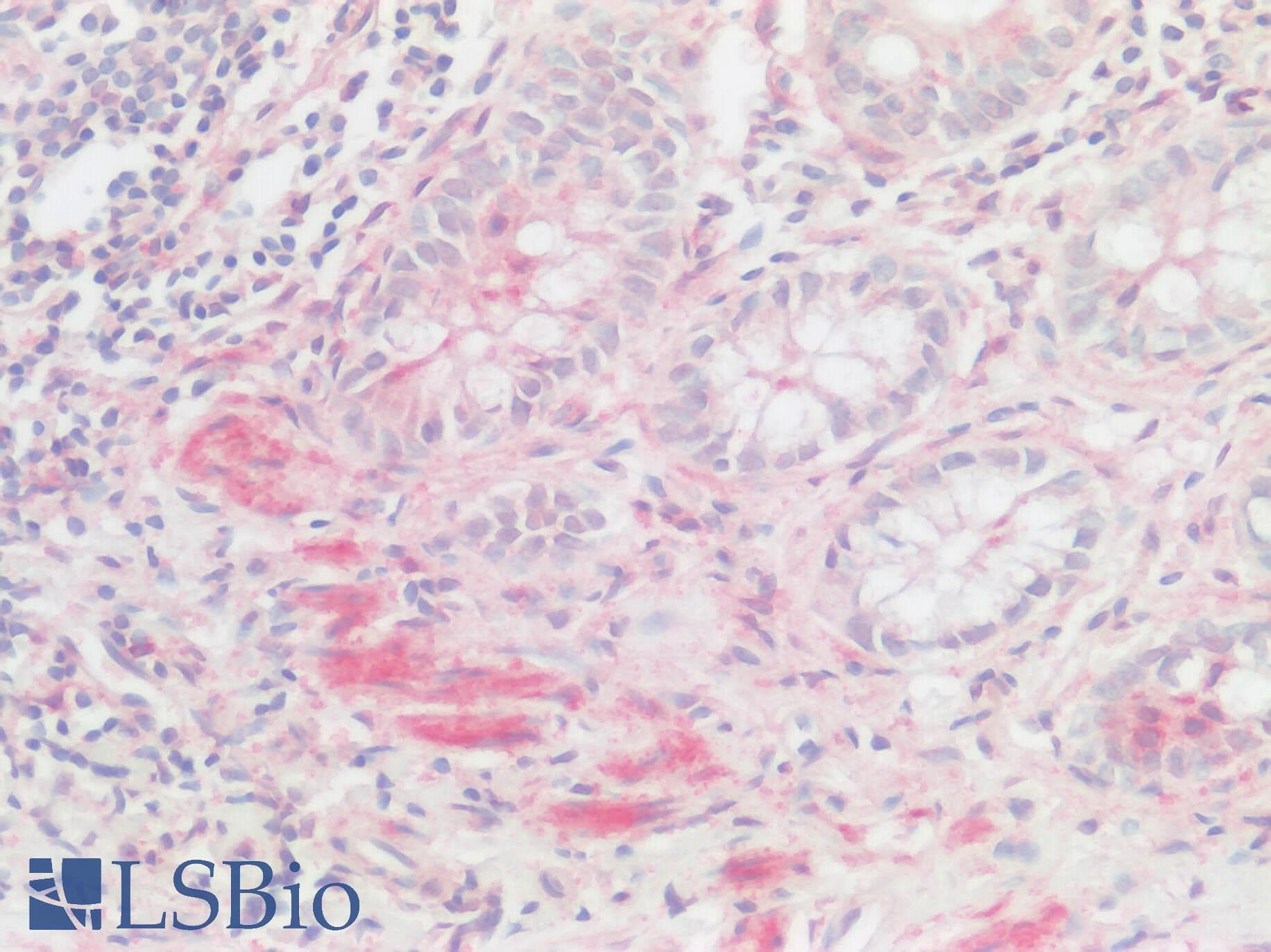 IHC-plus™ XCR1 Antibody (Cytoplasmic Domain)