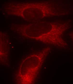 Polyclonal Rabbit anti-Human YWHAZ / 14-3-3 Zeta Antibody (phospho-Ser58, IHC, IF, WB)