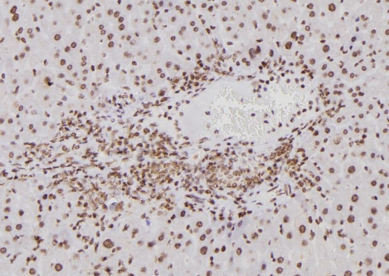 BTRCP / BETA-TRCP Antibody
