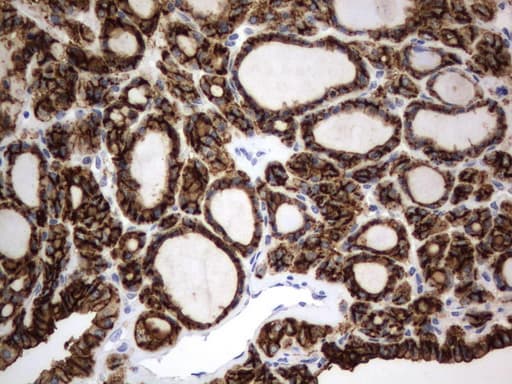 CD44 Antibody (clone UMAB133)