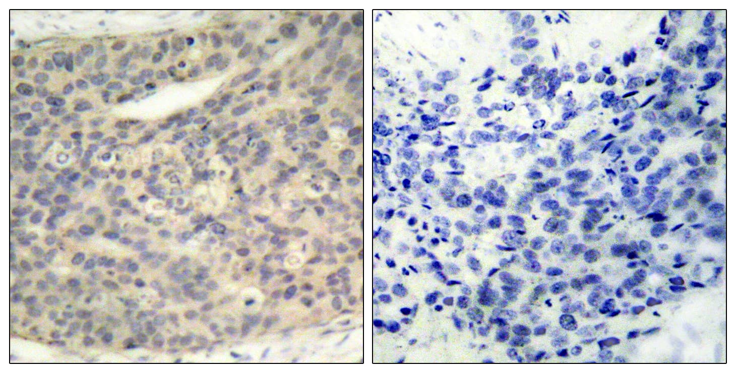 LIMK1 / LIMK Antibody (phospho-Thr508)
