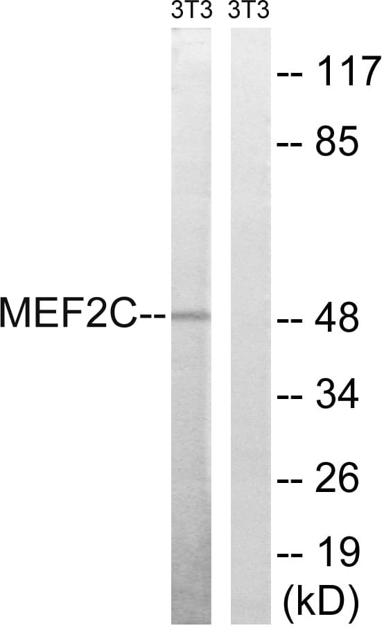 IHC-plus™ MEF2C Antibody (aa362-411)