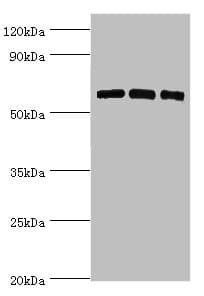 PRKAA2 / AMPK Alpha 2 Antibody (aa343-552)
