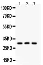 Polyclonal Rabbit anti-Human HOXA9 Antibody (aa1-204, WB)