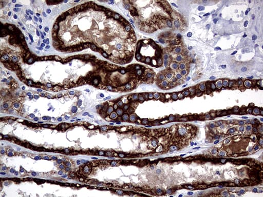 KRT18 / CK18 / Cytokeratin 18 Antibody (aa69-372, clone OTI10G8)