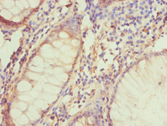 NIX / BNIP3L Antibody (aa1-187)