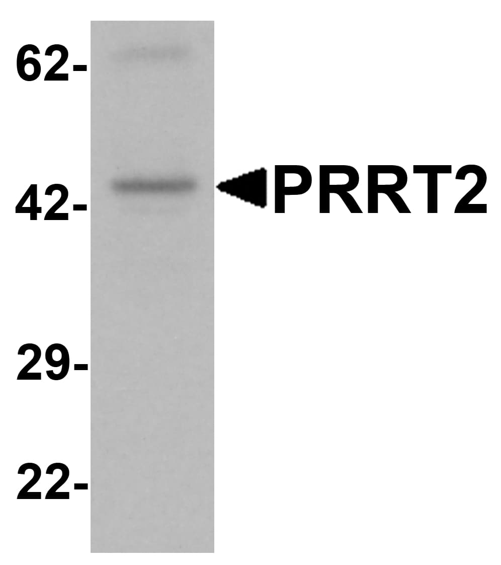 IHC-plus™ PRRT2 Antibody