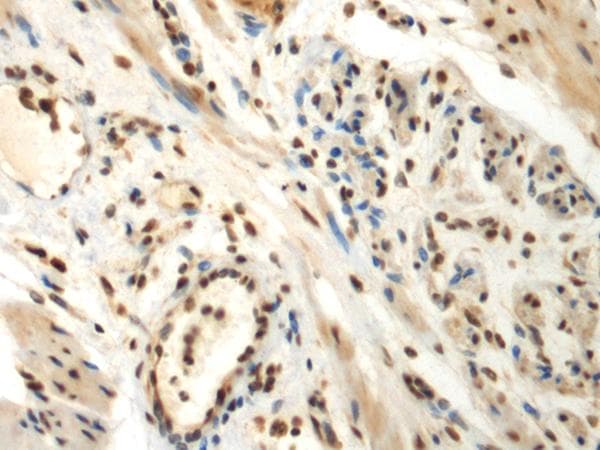 DDX39 Antibody