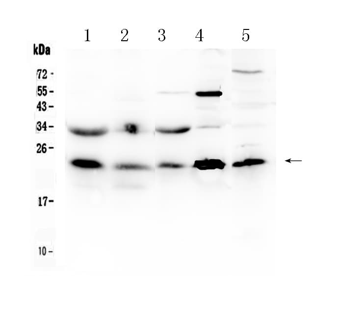 HSPB8 / H11 / HSP22 Antibody