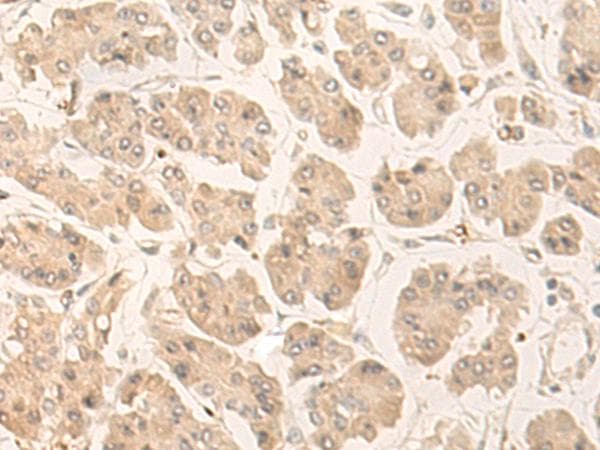 Polyclonal Rabbit anti-Human FABP4 / AP2 Antibody (IHC, WB)