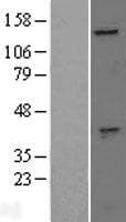 Human GAK Protein (Over-Expression Lysate Myc-DDK (Flag))