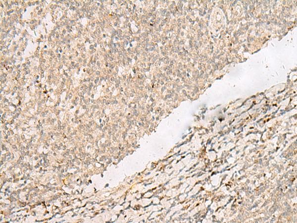 PADI4 / PAD4 Antibody