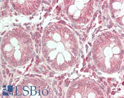 IHC-plus™ GCNT3 Antibody (aa390-418)