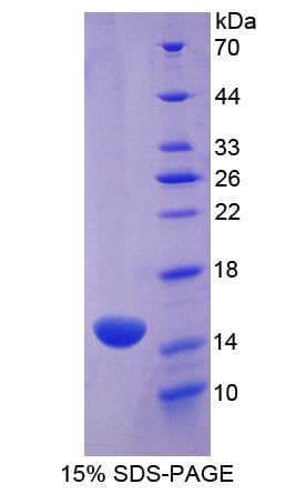 Mouse MPO / Myeloperoxidase Protein (Recombinant His)