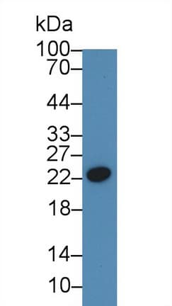 CRP / C-Reactive Protein Antibody (aa14-224)