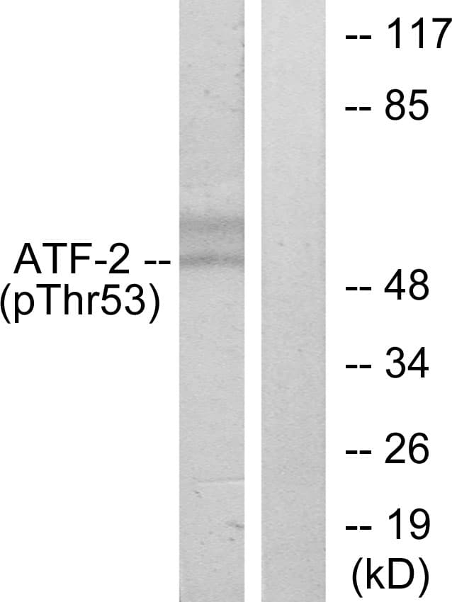 ATF2 Antibody (phospho-Thr71/Thr53)