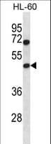 HAT1 Antibody (aa21-50)