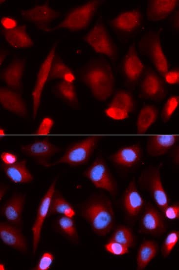FLI1 Antibody