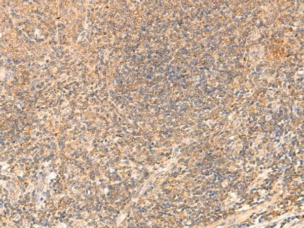 PDAP1 Antibody