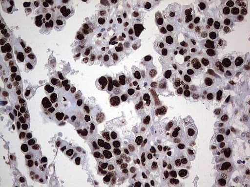 HNRNPL / hnRNP L Antibody (aa270-502, clone OTI9G7, Carrier-free)