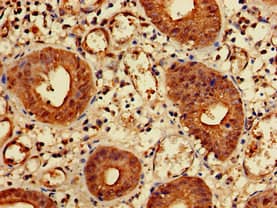 Polyclonal Rabbit anti-Human KIDINS220 / ARMS Antibody (IHC, IF, WB)