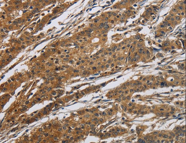 CLDN2 / Claudin 2 Antibody