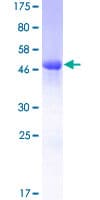 Human CALB1 / Calbindin Protein (Recombinant GST)
