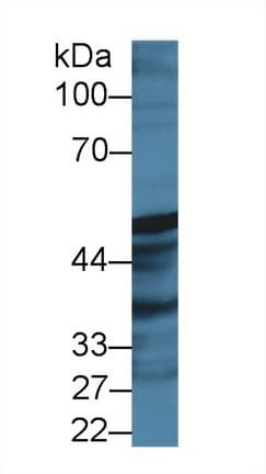 PGIS / PTGIS Antibody (aa1-500)