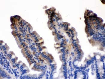 I-FABP / FABP2 Antibody