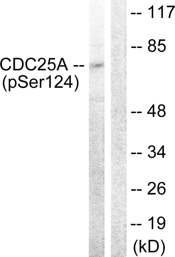 CDC25A Antibody (phospho-Ser124)