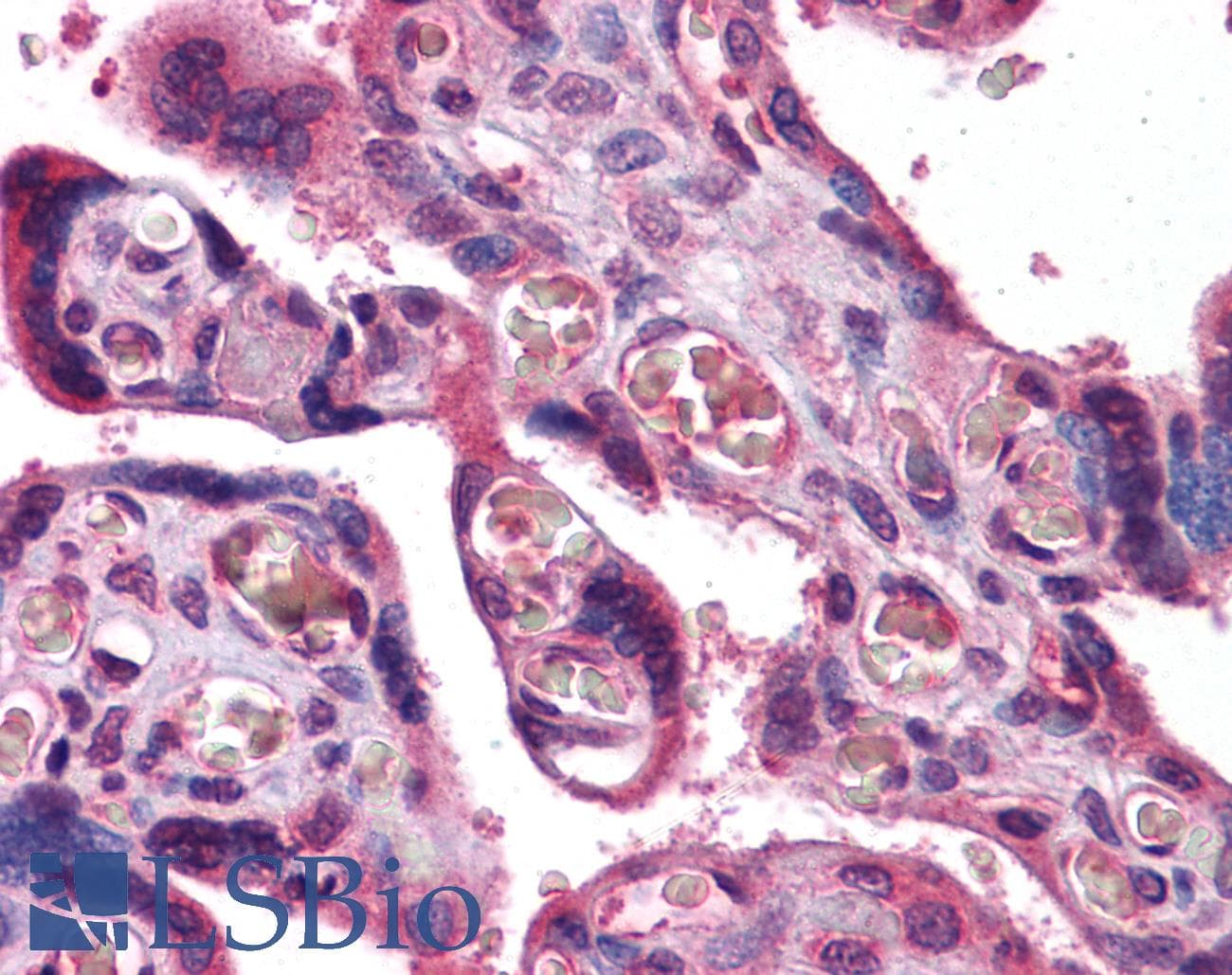 IHC-plus™ Polyclonal Rabbit anti-Human CD71 / Transferrin Receptor Antibody (IHC, WB)