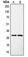 SURF1 Antibody (Internal)