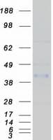 Human CRELD1 Protein (Recombinant Myc-DDK (Flag))