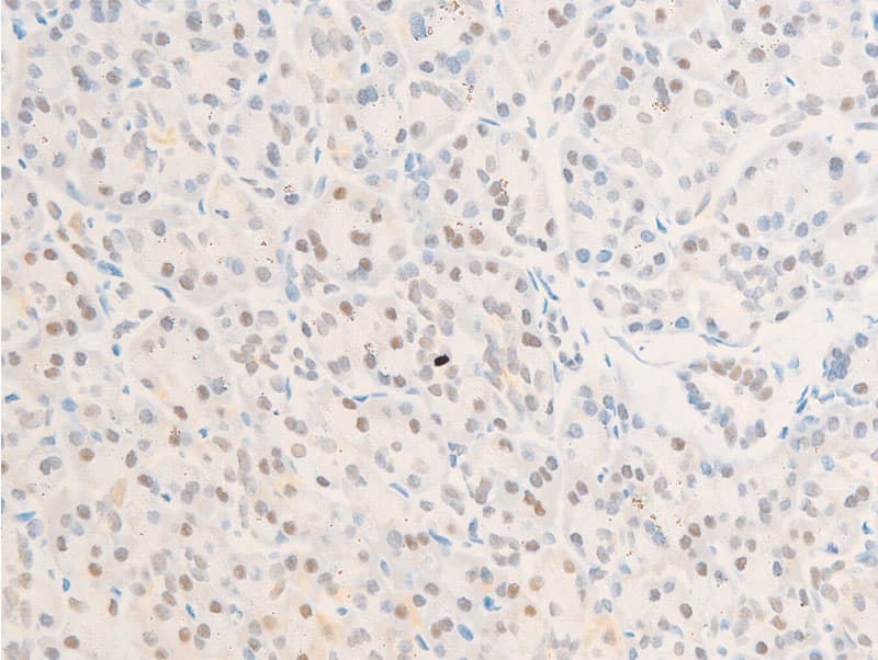 BIRC5 / Survivin Antibody (phospho-Thr117)