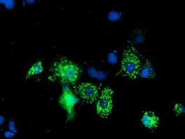 ALS2CR1 / NIF3L1 Antibody (clone OTI1F6)