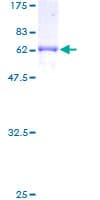 Human BUB3 Protein (Recombinant GST)