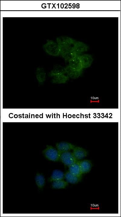 CDC42BPA / MRCK Antibody (aa373-564)