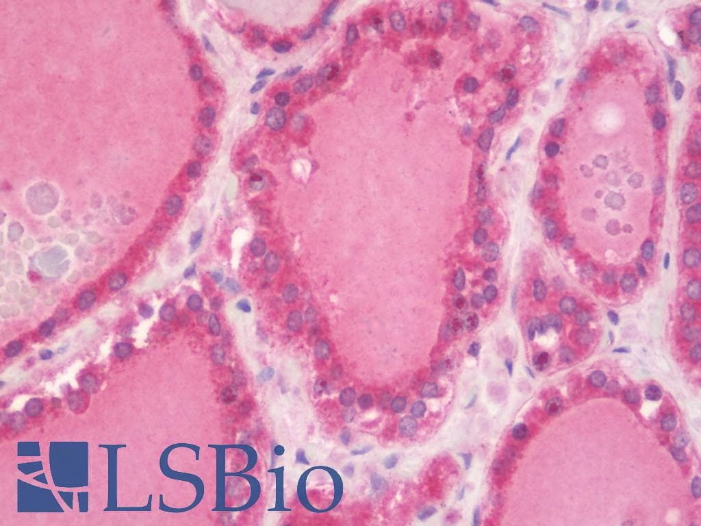 IHC-plus™ CALCR / Calcitonin Receptor Antibody (clone 2F7)