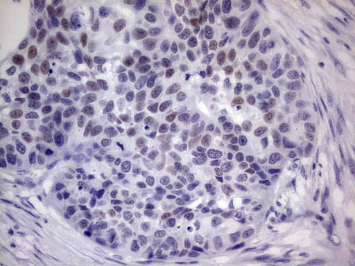 IKZF3 / AIOLOS Antibody (aa1-301, clone OTI2B9, Carrier-free)