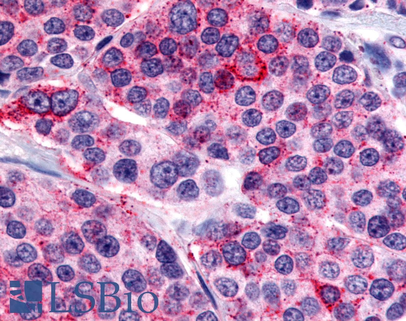 PathPlus™ CALCR / Calcitonin Receptor Antibody (N-Terminus)